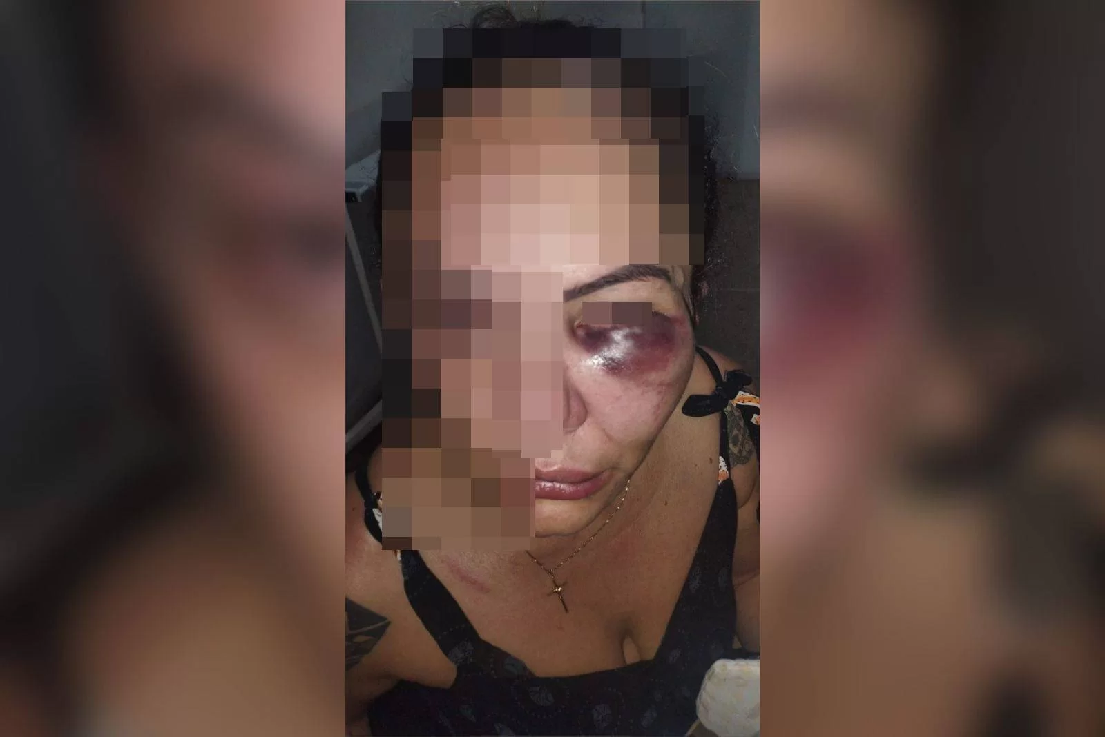 Homem agride, enforca e desfigura rosto de mulher no Entorno do DF Homem agride, enforca e desfigura rosto de mulher no Entorno do DF