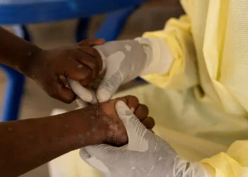 Tailândia confirma primeiro caso de nova variante da mpox